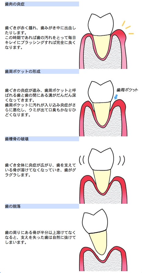 歯６.tiff